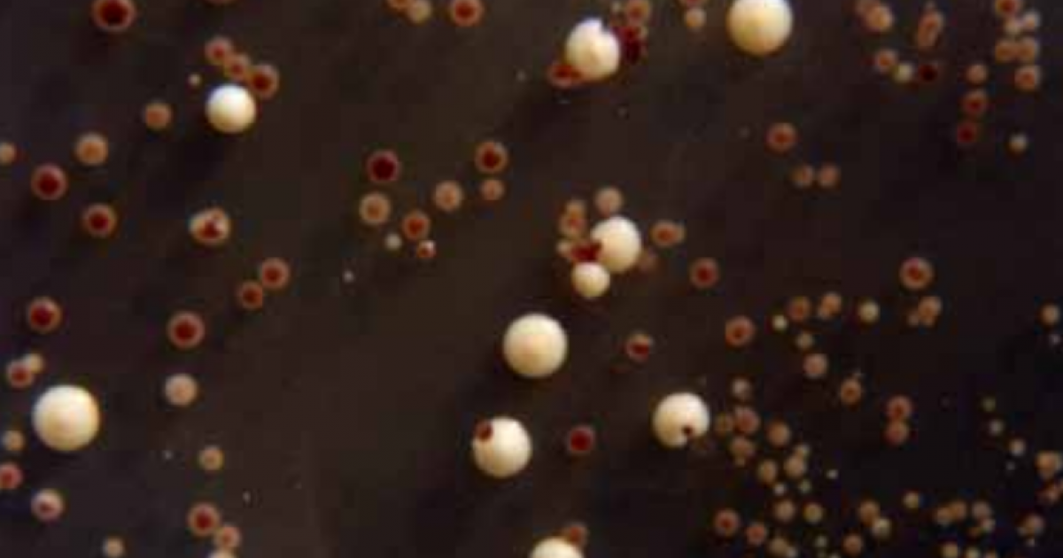 Tp Effet Mutagène Des Uv Sur Les Levures